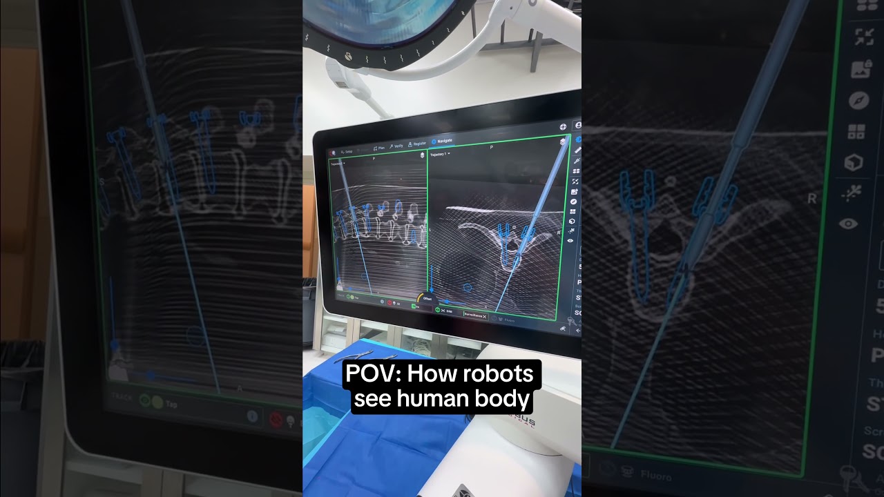 This isn’t an x-ray 👇