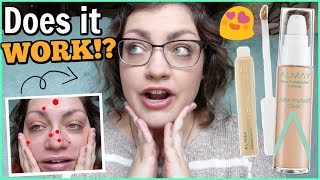 ACNE FIGHTING MAKEUP!? | Let's Test!: ALMAY Clear Complexion Makeup (Foundation & Concealer)