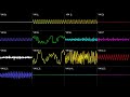 NEOGEO Metal Slug Game Over Oscilloscope View 