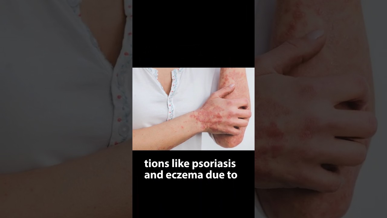 Drinking Alcoholic Beverages Effects On Skin, Liver, Etc..