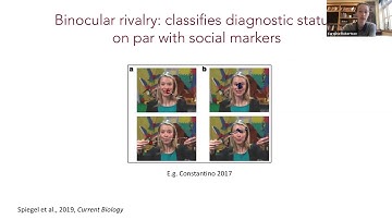 Talk: Sensory processing in autism - Translational markers and circuit-level insights