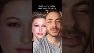 Celebrity Hailey Bieber tells us she has natural lips? 👄💉 Net Worth