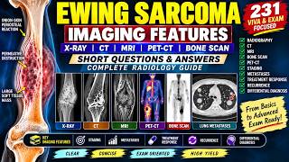 Ewing Sarcoma Imaging Features Short Questions  Answers Complete Radiology Guide screenshot 1