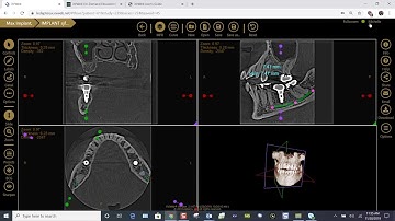 Training: Apteryx XVWeb 3D: Information, Help and Support Features