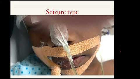 Paediatric Critical Care Management of a  child with Super Refractory Status Epilepticus