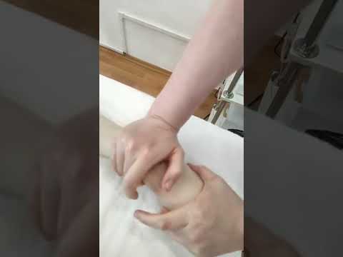 Лечебный массаж при Ишиасе( ущемление седалищного нерва), радикулопатии.