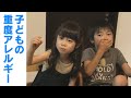 お菓子で治す！? “卵焼きの味を知らない少女たち” ‥子どもの食物アレルギーとどう向き合うか。CBCテレビ　ドキュメンタリー