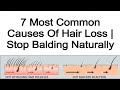 7 Most Common Causes Of Hair Loss | Hair Fall Symptoms and Treatments | Stop Balding Naturally