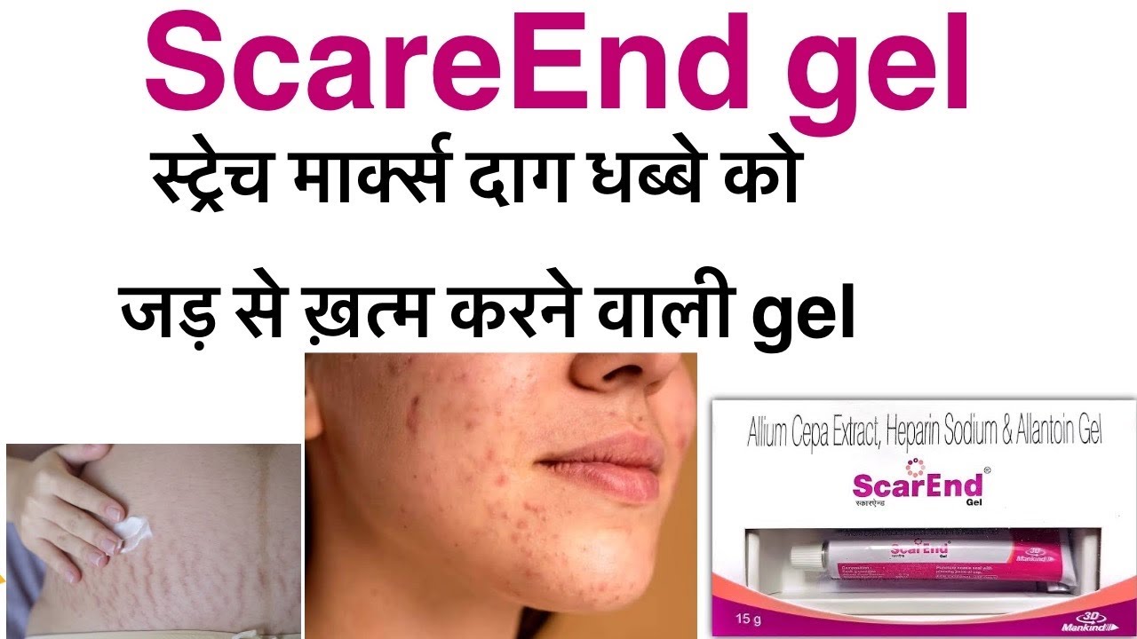 Scarend gel uses in hindi/allium cepa extract heparin sodium