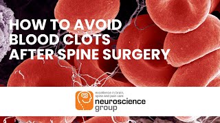 How to Avoid Blood Clots After Surgery