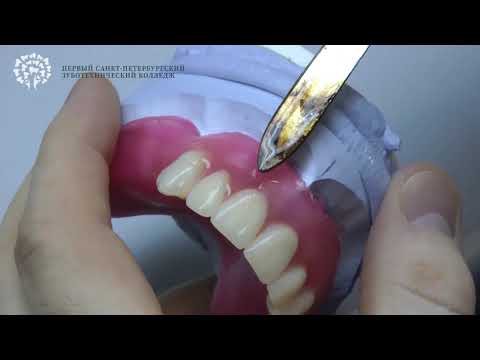 2) Профессия  зубной техник