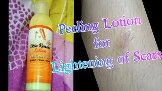 Effective Peeling Lotion to Lighten and further Remove Scars (Peklat) | MNL Info