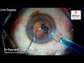 Live surgery from nandadeep eye hospital dr sourabh patwardhan for appointments call 9220001000