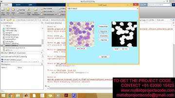 Detection and counting of blood cells using image segmentation A review matlab projects code