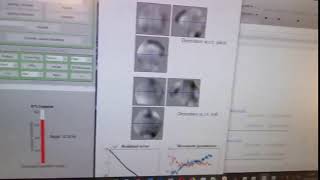 SPM fMRI vid 14k345pfg34