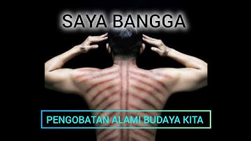 manfaat pengobatan alami budaya kita "KEROKAN" | ceramah dr.Agus Rahmadi