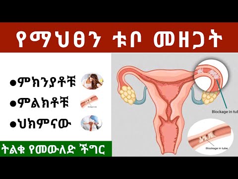 ቪዲዮ: የማህፀን ሥር ያለው ሊዮዮማ ምንድን ነው?