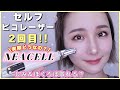 【検証】セルフピコレーザー2回目‼️シミ＆ホクロの効果は？🤔正直レビュー！！【NEATCELL】