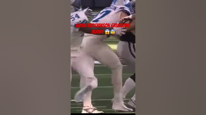 Aidan Hutchinson Broke His Leg