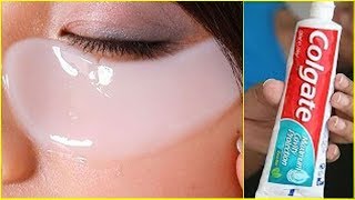 Colgate सिर्फ 1 मिनट में आपके आंखों के काले घेरे(Dark Circles)को गायब कर देगा - DARK CIRCLES REMOVE