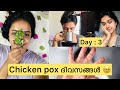 Chicken pox days day 3