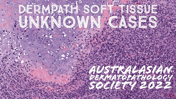 Dermpath Soft Tissue Pathology Cases for Australasian Dermatopathology Society 2022 meeting
