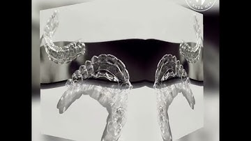 QUY TRÌNH NIỀNG RĂNG TRONG SUỐT