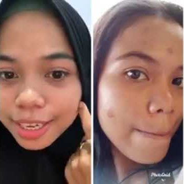 Lavina skincare acne series