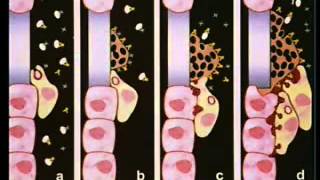 mycology9.flv