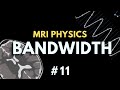 MRI Field of View (FOV), Matrix Size, Receiver Bandwidth, Dwell Time | MRI Physics Course #11