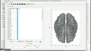 MRI Graph Analysis 1.0.0 - Part 1
