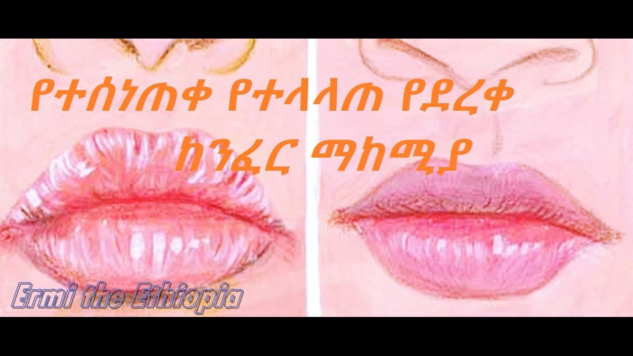 የተቆራረጠ የተላላጠ የተስነጠቀ ከንፈር ማከሚያ /Dry Cracked Chapped Lips