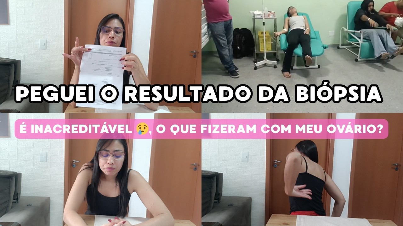 LAPAROTOMIA EXPLORADORA: O RESULTADO DA BIÓPSIA ME DEIXOU EM CHOQUE!