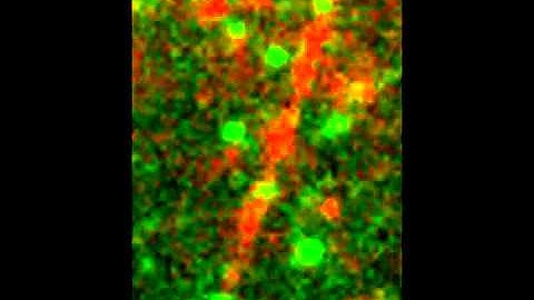 Molecular Biophysics of Mitosis: CENP-E kinesin tracks dynamic microtubule tip