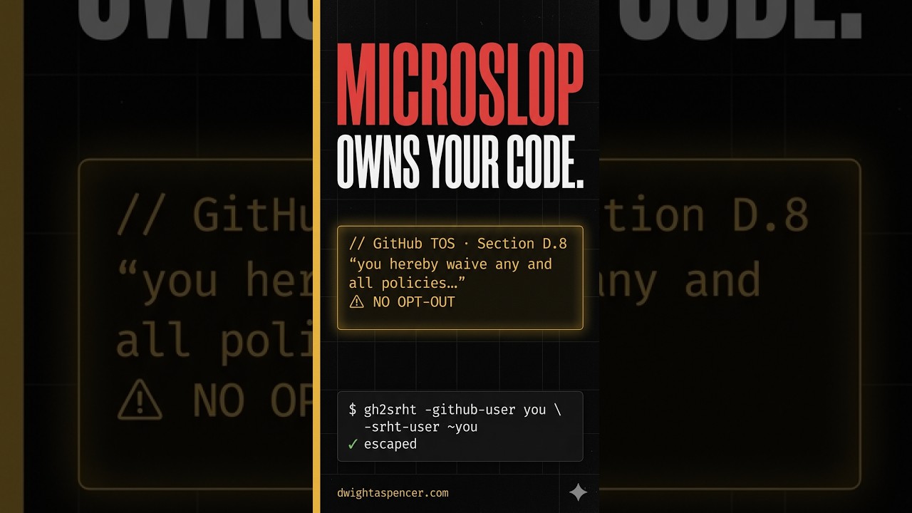 Microslop owns your Source Code. Legally. - YouTube