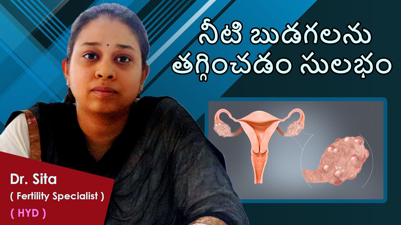 Cure PCOD in 1 month | How to lose 10 kgs weight | PCOD Diet : Dr  Sita