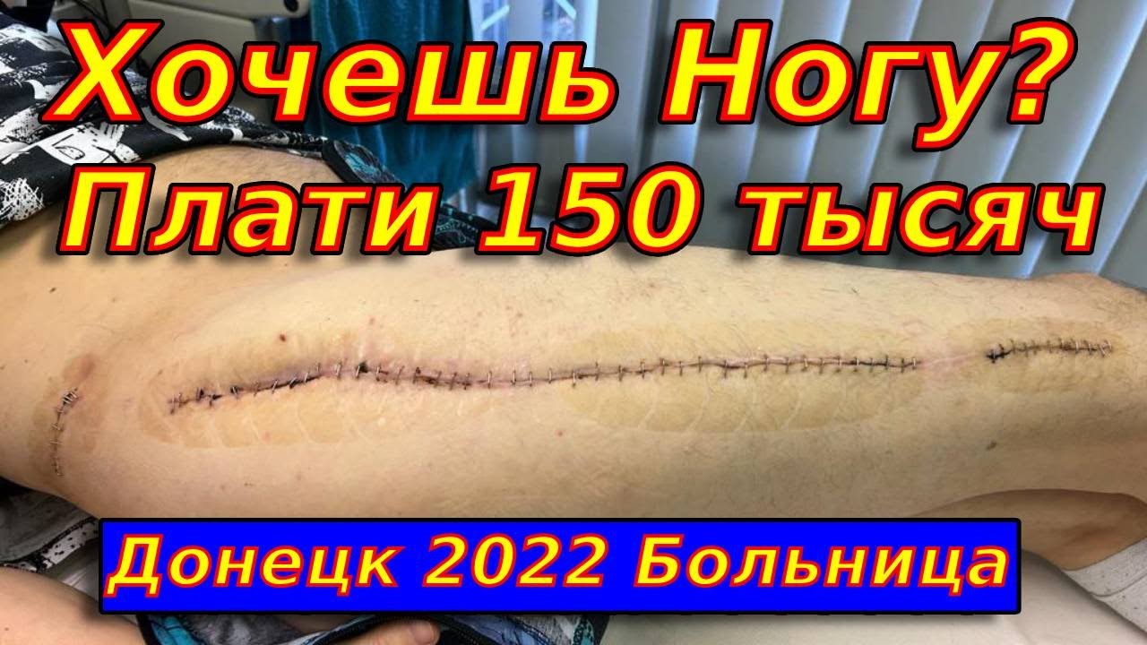 Мариуполь 2022. Хочешь ногу? Плати Деньги или Ампутация. Донецк палата с Денеэровцами.