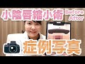 小陰唇縮小術こだわりを症例写真で解説・他院修正【婦人科形成】