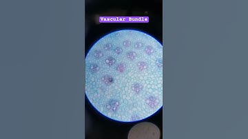 Detailed view of Monocot stem under microscope | Vascular bundle | Xylem and phloem #shorts #cell