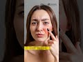 Skin Barrier Damage Signs | Dry Skin, Redness & Sensitivity Explained | Skin Care Tips Kochi