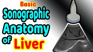 Basic Sonographic Anatomy of the Liver