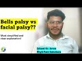 Bells palsy vs facial palsy  physiotherapy  ishant kumar arora  phyx pain solutions  nitin arora