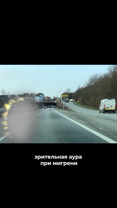 Зрительная аура при мигрени #головнаяболь #мигрень #аура - YouTube
