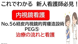 これでわかる　新人看護師必見！　内視鏡看護　介助No.56 経皮内視鏡的胃瘻造設術　PEG⑤　治療の流れと看護