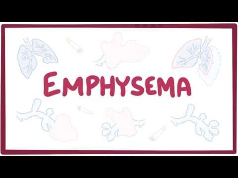 Video: Emphysema