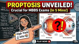Proptosis Explained in 5 Minutes | Mnemonic🔥 + Differential Diagnosis