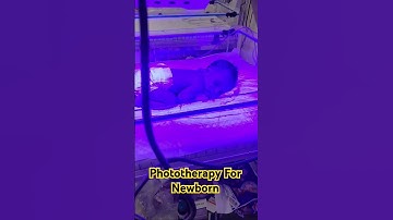 Phototherapy For Newborn Baby! #ytshorts #trending #shorts #viralshorts #shortsviral #new #jaundice