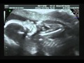 Baby mup gapen en duimen