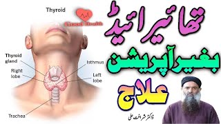 thyroid gland without operation treatment