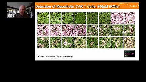 Applications in biomarker discovery and CAR T therapy using high-plex RNA